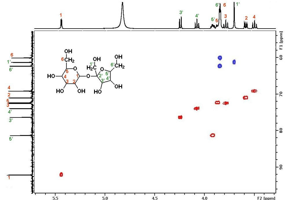 HSQC spectrum