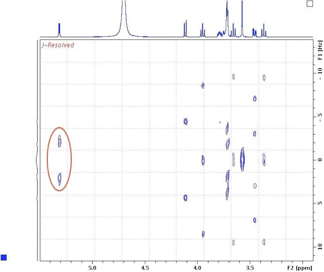 J-Resolved spectrum