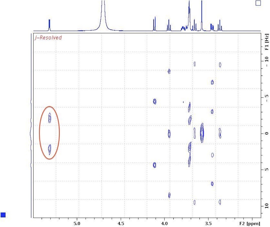 J-Resolved spectrum